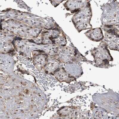 Immunohistochemistry-Paraffin: C8orf58 Antibody [NBP1-93836]