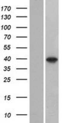 Western Blot: C8orf58 Overexpression Lysate [NBP2-08732]