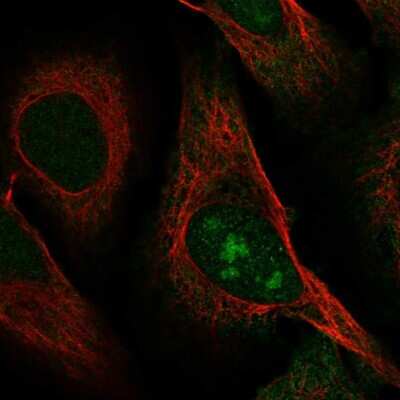 Immunocytochemistry/ Immunofluorescence: C8orf59 Antibody [NBP2-57941]