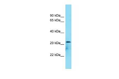 Western Blot: C8orf74 Antibody [NBP2-82952]