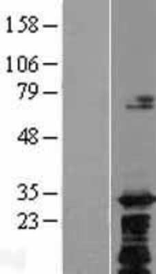 Western Blot: C8orf74 Overexpression Lysate [NBP2-08543]