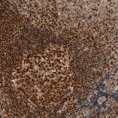 Immunohistochemistry-Paraffin: C8orf76 Antibody [NBP1-82221]