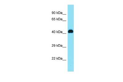 Western Blot: C8orf76 Antibody [NBP2-84572]