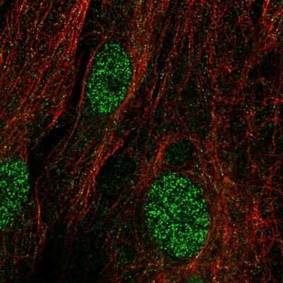 Immunocytochemistry/ Immunofluorescence: TRMT9B Antibody [NBP1-87541]