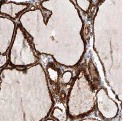 Immunohistochemistry-Paraffin: TRMT9B Antibody [NBP1-87541]