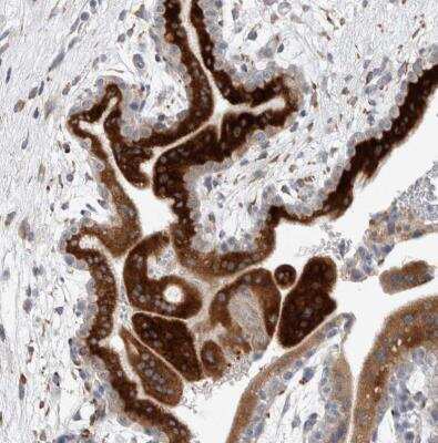 Immunohistochemistry-Paraffin: TRMT9B Antibody [NBP1-87541]