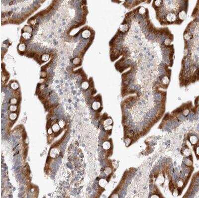 Immunohistochemistry-Paraffin: TRMT9B Antibody [NBP1-87541]