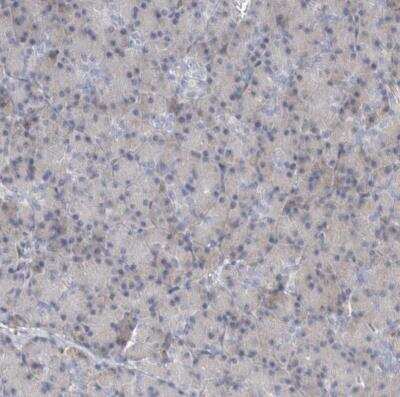 Immunohistochemistry-Paraffin: TRMT9B Antibody [NBP1-87541]