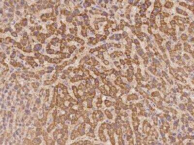 Immunohistochemistry-Paraffin: C8orf86 Antibody [NBP3-06234]