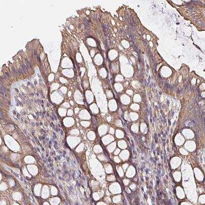 Immunohistochemistry-Paraffin: ARHGEF39 Antibody [NBP2-31850]