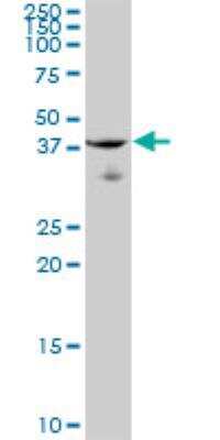 Western Blot: ARHGEF39 Antibody [H00084904-B01P]