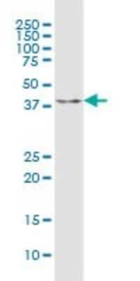 Western Blot: ARHGEF39 Antibody [H00084904-B02P]