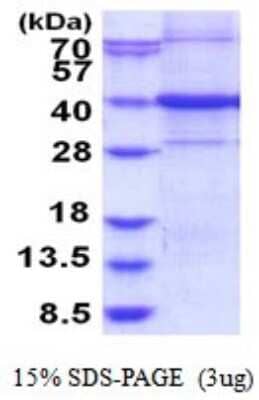 SDS-PAGE: Recombinant Human ARHGEF39 His Protein [NBP2-51856]