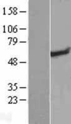 Western Blot: RAD26L Overexpression Lysate [NBL1-08579]