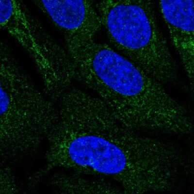 Immunocytochemistry/ Immunofluorescence: C9orf103 Antibody [NBP2-58555]