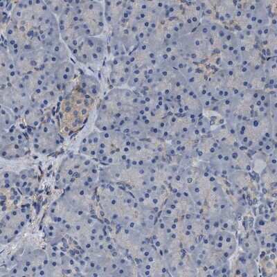 Immunohistochemistry-Paraffin: C9orf103 Antibody [NBP1-88751]