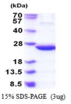 SDS-PAGE: Recombinant E. coli C9orf103 His Protein [NBP2-51844]