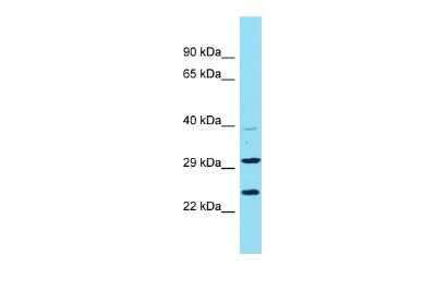 Western Blot: C9orf106 Antibody [NBP3-09681]