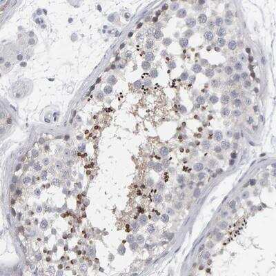 Immunohistochemistry: EQTN Antibody [NBP1-90868]