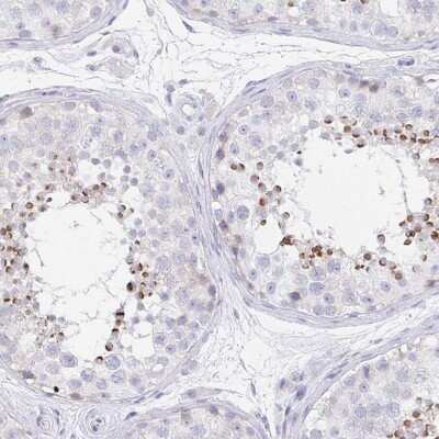 Immunohistochemistry-Paraffin: EQTN Antibody [NBP1-90868]