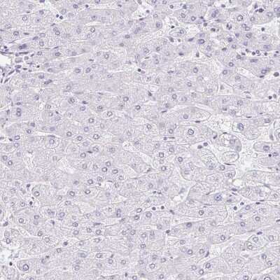 Immunohistochemistry-Paraffin: EQTN Antibody [NBP1-90868]