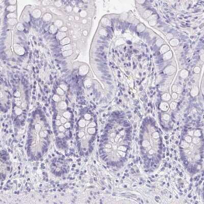Immunohistochemistry-Paraffin: EQTN Antibody [NBP1-90868]