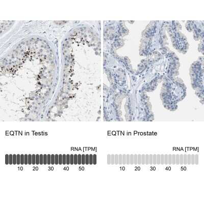 Immunohistochemistry-Paraffin: EQTN Antibody [NBP1-90869]