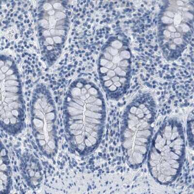 Immunohistochemistry-Paraffin: EQTN Antibody [NBP1-90869]