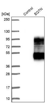 Western Blot: EQTN Antibody [NBP1-90869]