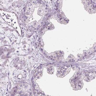 Immunohistochemistry-Paraffin: CFAP157 Antibody [NBP1-90934]