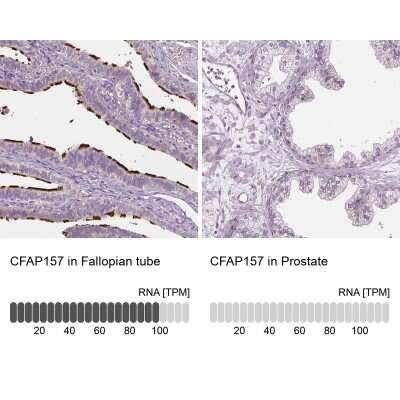 Immunohistochemistry-Paraffin: CFAP157 Antibody [NBP1-90934]