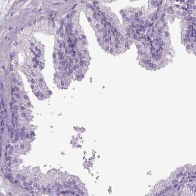 Immunohistochemistry-Paraffin: CFAP157 Antibody [NBP1-91072]