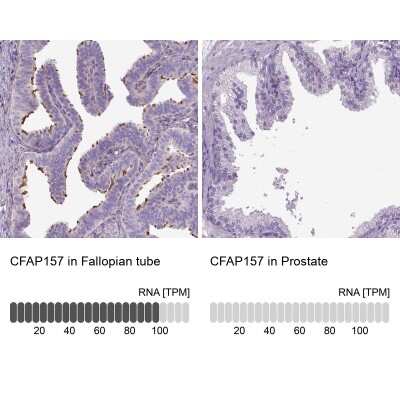 Immunohistochemistry-Paraffin: CFAP157 Antibody [NBP1-91072]