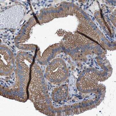 Immunohistochemistry-Paraffin: TMEM261 Antibody [NBP1-93465]