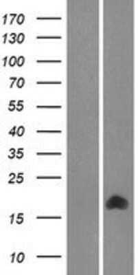 Western Blot: TMEM261 Overexpression Lysate [NBP2-05881]