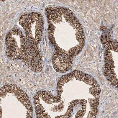 Immunohistochemistry-Paraffin: FAM221B Antibody [NBP1-91050]