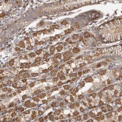 Immunohistochemistry-Paraffin: FAM221B Antibody [NBP1-90932]