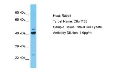 Western Blot: C9orf135 Antibody [NBP2-84574]