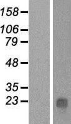 Western Blot: C9orf139 Overexpression Lysate [NBP2-04505]