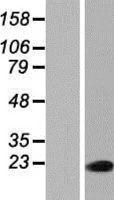 Western Blot: PAXX Overexpression Lysate [NBP2-04782]