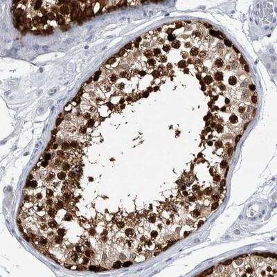 Immunohistochemistry-Paraffin: LURAP1L Antibody [NBP1-90796]