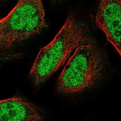 Immunocytochemistry/ Immunofluorescence: C9orf152 Antibody [NBP2-14423]