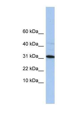 Western Blot: C9orf153 Antibody [NBP1-91452]