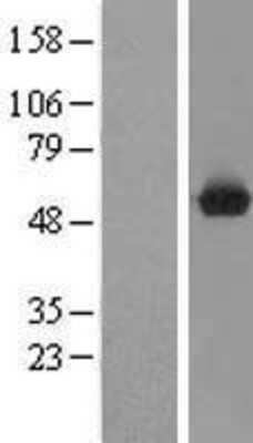 Western Blot: nef-associated protein 1 Overexpression Lysate [NBL1-08585]