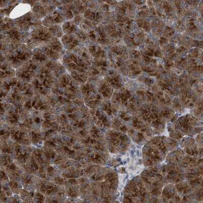 Immunohistochemistry-Paraffin: C9orf16 Antibody [NBP1-83955]