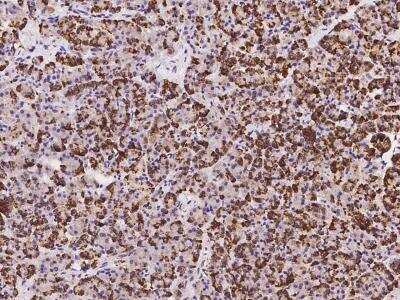 Immunohistochemistry-Paraffin: C9orf163 Antibody [NBP3-06061]