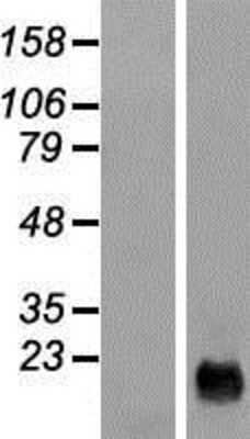 Western Blot: Cysteine Rich Tail 1 Overexpression Lysate [NBL1-08589]