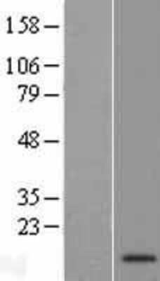 Western Blot: C9orf170 Overexpression Lysate [NBP2-08950]