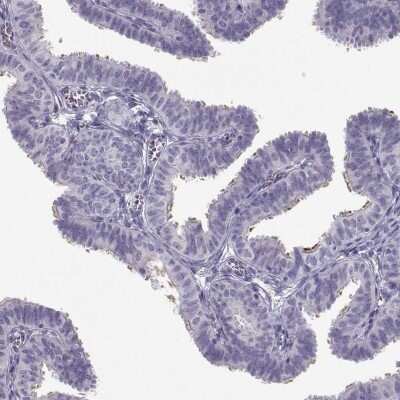 Immunohistochemistry-Paraffin: CFAP77 Antibody [NBP2-62635]