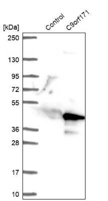 Western Blot: CFAP77 Antibody [NBP1-93735]